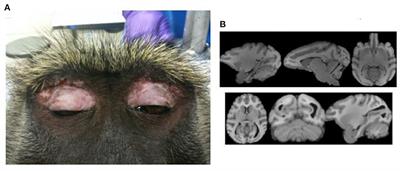 Neuroimaging in the Epileptic Baboon